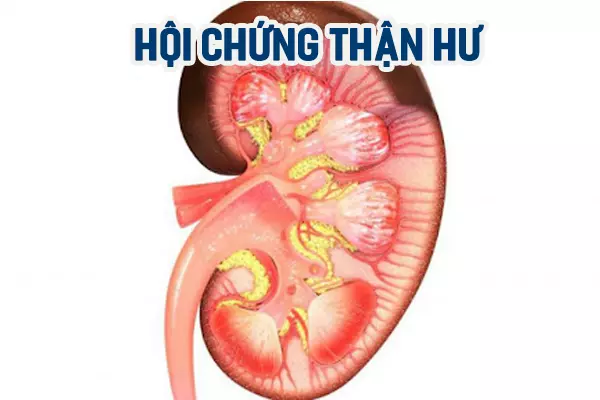 Sinh thiết thận trong HỘI CHỨNG THẬN HƯ nguyên phát ở người lớn